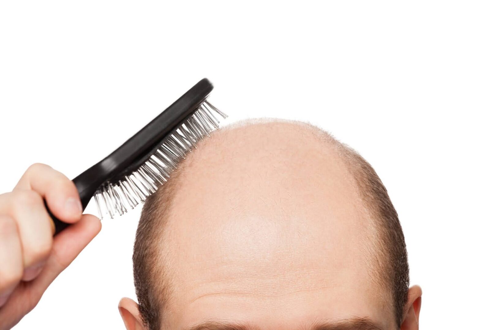 Human alopecia or hair loss - adult man hand holding comb on bald head